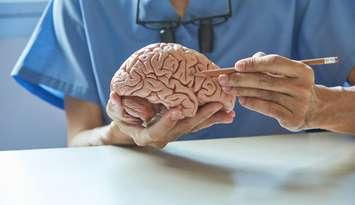 A model of the human brain, illustrating how dementia may occur.  © Can Stock Photo / srikijt